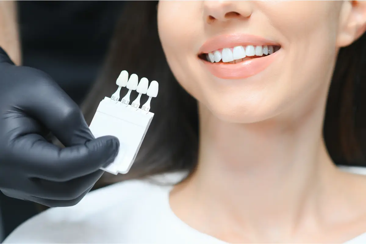Veneers Near Me: Your Guide to a Stunning Smile